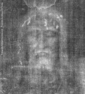Something new found on Shroud of Turin, WDTPRS POLL!